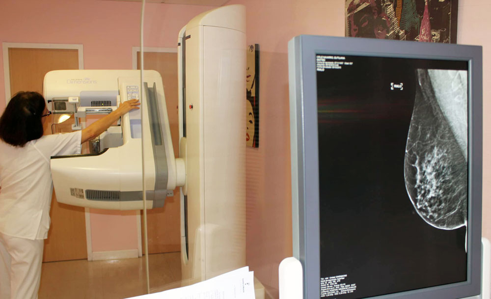 mamografía 40 años